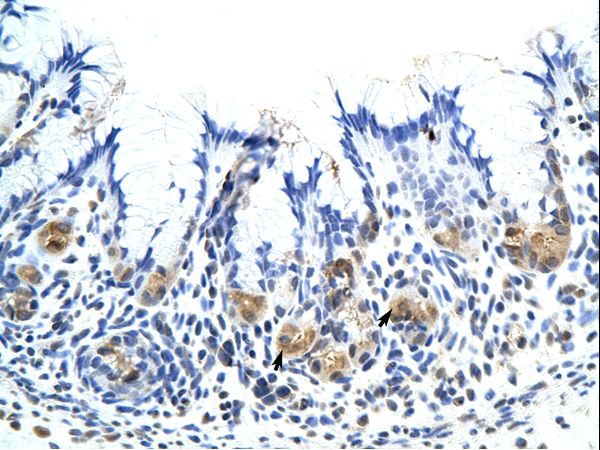 Placental Lactogen Antibody - CSH1 antibody ARP40350_T100-NP_001308-CSH1 (chorionic somatomammotropin hormone 1 (placental lactogen)) Antibody was used in IHC to stain formalin-fixed, paraffin-embedded human stomach.  This image was taken for the unconjugated form of this product. Other forms have not been tested.