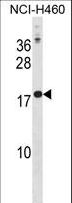 Placental Lactogen Antibody - CSH1 Antibody western blot of NCI-H460 cell line lysates (35 ug/lane). The CSH1 antibody detected the CSH1 protein (arrow).