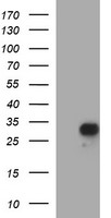 Placental Lactogen Antibody - HEK293T cells were transfected with the pCMV6-ENTRY control (Left lane) or pCMV6-ENTRY CSH1 (Right lane) cDNA for 48 hrs and lysed. Equivalent amounts of cell lysates (5 ug per lane) were separated by SDS-PAGE and immunoblotted with anti-CSH1.