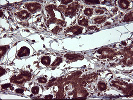 Placental Lactogen Antibody - IHC of paraffin-embedded Human breast tissue using anti-CSH1 mouse monoclonal antibody. (Heat-induced epitope retrieval by 10mM citric buffer, pH6.0, 120°C for 3min).