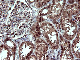 Placental Lactogen Antibody - IHC of paraffin-embedded Human Kidney tissue using anti-CSH1 mouse monoclonal antibody. (Heat-induced epitope retrieval by 10mM citric buffer, pH6.0, 120°C for 3min).