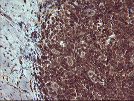 Placental Lactogen Antibody - IHC of paraffin-embedded Human lymph node tissue using anti-CSH1 mouse monoclonal antibody. (Heat-induced epitope retrieval by 10mM citric buffer, pH6.0, 120°C for 3min).