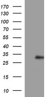 Placental Lactogen Antibody - HEK293T cells were transfected with the pCMV6-ENTRY control (Left lane) or pCMV6-ENTRY CSH1 (Right lane) cDNA for 48 hrs and lysed. Equivalent amounts of cell lysates (5 ug per lane) were separated by SDS-PAGE and immunoblotted with anti-CSH1.