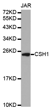 Placental Lactogen Antibody - Western blot analysis of extracts of JAR cells.