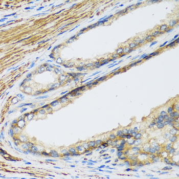 Placental Lactogen Antibody - Immunohistochemistry of paraffin-embedded human prostate.