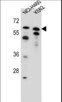 PLAG1 Antibody - PLAG1 Antibody western blot of NCI-H460,K562 cell line lysates (35 ug/lane). The PLAG1 antibody detected the PLAG1 protein (arrow).