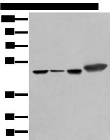 PLAG1 Antibody - Western blot analysis of Hepg2 A431 Hela and A549 cell lysates  using PLAG1 Polyclonal Antibody at dilution of 1:250