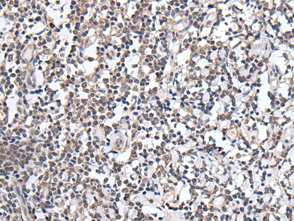PLAG1 Antibody - Immunohistochemistry of paraffin-embedded Human tonsil tissue  using PLAG1 Polyclonal Antibody at dilution of 1:25(×200)