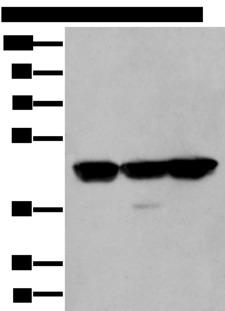 PLAG1 Antibody - Western blot analysis of Hela A431 and Hepg2 cell lysates  using PLAG1 Polyclonal Antibody at dilution of 1:200