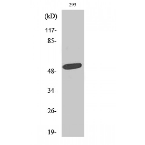 PLAGL1 / ZAC Antibody - Western blot of ZAC1 antibody