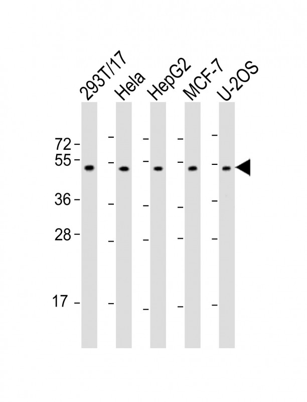 PLAGL1 / ZAC Antibody - All lanes: Anti-PLAGL1 Antibody (N-Term) at 1:2000 dilution. Lane 1: 293T/17 whole cell lysate. Lane 2: HeLa whole cell lysate. Lane 3: HepG2 whole cell lysate. Lane 4: MCF-7 whole cell lysate. Lane 5: U-2OS whole cell lysate Lysates/proteins at 20 ug per lane. Secondary Goat Anti-Rabbit IgG, (H+L), Peroxidase conjugated at 1:10000 dilution. Predicted band size: 51 kDa. Blocking/Dilution buffer: 5% NFDM/TBST.