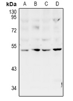 PLAGL1 / ZAC Antibody - Western blot analysis of ZAC expression in Hela (A), U87MG (B), PC12 (C), CT26 (D) whole cell lysates.
