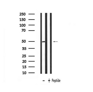 PLAGL1 / ZAC Antibody - Western blot analysis of extracts of rat muscle using PLAGL1 antibody.