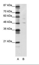 PLAGL1 / ZAC Antibody - A: Marker, B: 293T Cell Lysate.  This image was taken for the unconjugated form of this product. Other forms have not been tested.
