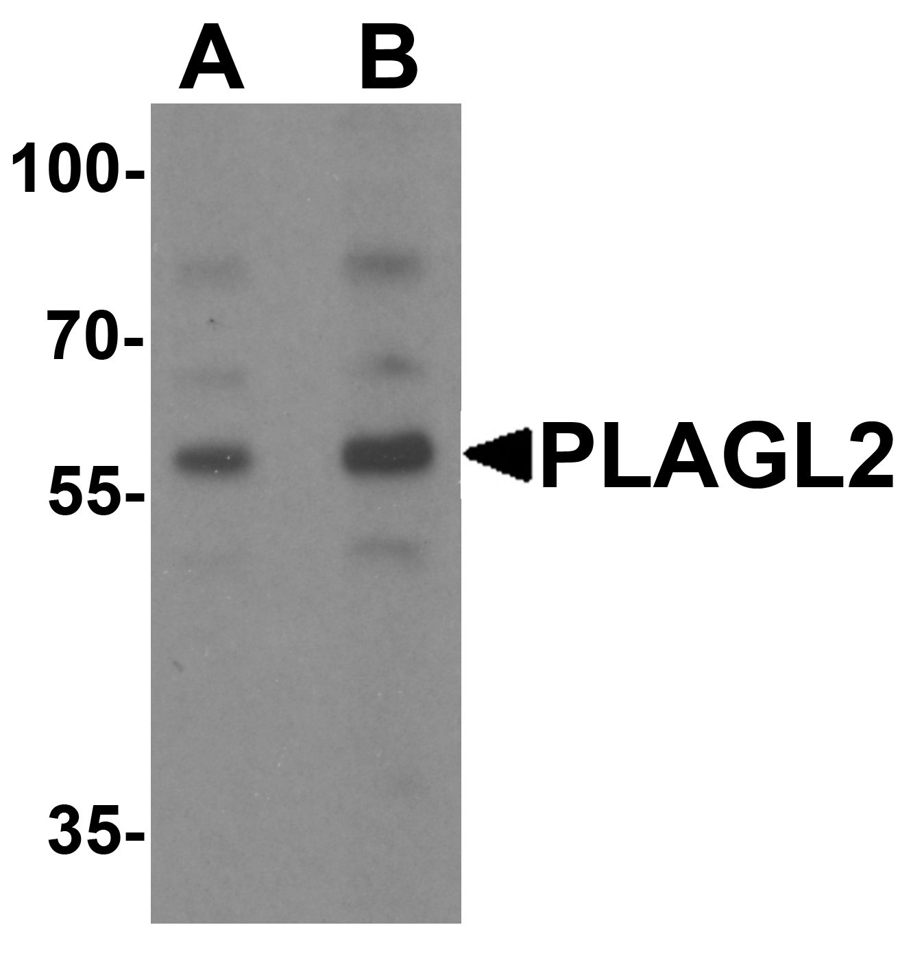 Anti-PLAGL2 Antibody | Rabbit Anti-Human Polyclonal ELISA,IF,IHC,WB | LSBio