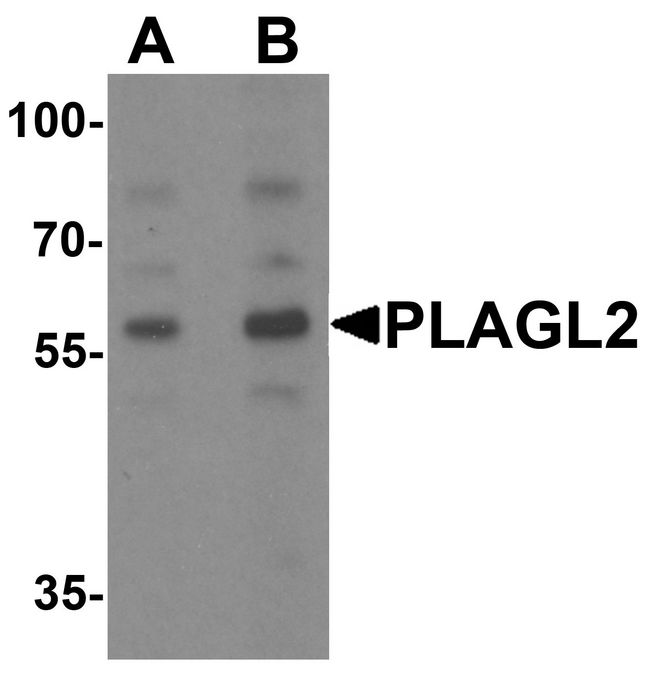 PLAGL2 Antibody - Western blot analysis of PLAGL2 in rat brain tissue lysate with PLAGL2 antibody at (A) 1 and (B) 2 ug/ml.