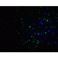 PLAGL2 Antibody - Immunofluorescence of PLAGL2 in rat brain tissue with PLAGL2 antibody at 20 µg/ml.