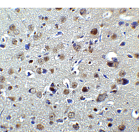 PLAGL2 Antibody - Immunohistochemistry of PLAGL2 in rat brain tissue with PLAGL2 antibody at 2 µg/ml.