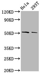 PLAGL2 Antibody - Western Blot Positive WB detected in: Hela whole cell lysate, 293T whole cell lysate All Lanes: PLAGL2 antibody at 3.8µg/ml Secondary Goat polyclonal to rabbit IgG at 1/50000 dilution Predicted band size: 55 KDa Observed band size: 55 KDa