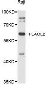 PLAGL2 Antibody - Western blot analysis of extracts of Raji cells, using PLAGL2 antibody at 1:3000 dilution. The secondary antibody used was an HRP Goat Anti-Rabbit IgG (H+L) at 1:10000 dilution. Lysates were loaded 25ug per lane and 3% nonfat dry milk in TBST was used for blocking. An ECL Kit was used for detection and the exposure time was 90s.