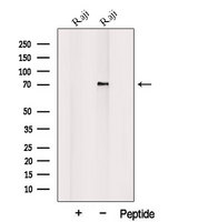 PLAGL2 Antibody - Western blot analysis of extracts of MCF-7 using PLAGL2 antibody. The lane on the left was treated with blocking peptide.