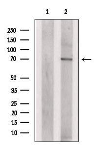 PLAGL2 Antibody