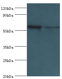 PLAP / Alkaline Phosphatase Antibody - Western blot. All lanes: Alkaline phosphatase, placental type antibody at 8 ug/ml. Lane 1: A549 whole cell lysate. Lane 2: HeLa whole cell lysate. secondary Goat polyclonal to rabbit at 1:10000 dilution. Predicted band size: 58 kDa. Observed band size: 58 kDa.