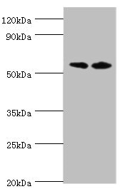 PLAP / Alkaline Phosphatase Antibody - Western blot All lanes: Alkaline phosphatase, placental type antibody at 8µg/ml Lane 1: A549 whole cell lysate Lane 2: Hela whole cell lysate Secondary Goat polyclonal to rabbit IgG at 1/10000 dilution Predicted band size: 58 kDa Observed band size: 58 kDa