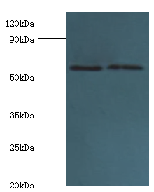 PLAP / Alkaline Phosphatase Antibody - Western blot. All lanes: Alkaline phosphatase, placental type antibody at 6 ug/ml. Lane 1: A549 whole cell lysate. Lane 2: HeLa whole cell lysate. secondary Goat polyclonal to rabbit at 1:10000 dilution. Predicted band size: 58 kDa. Observed band size: 58 kDa.