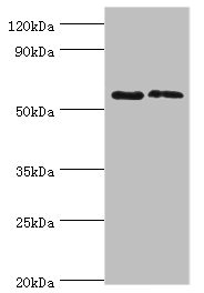 PLAP / Alkaline Phosphatase Antibody - Western blot All lanes: Alkaline phosphatase, placental type antibody at 6µg/ml Lane 1: A549 whole cell lysate Lane 2: Hela whole cell lysate Secondary Goat polyclonal to rabbit IgG at 1/10000 dilution Predicted band size: 58 kDa Observed band size: 58 kDa