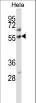 PLAP / Alkaline Phosphatase Antibody - ALPP Antibody western blot of HeLa cell line lysates (35 ug/lane). The ALPP antibody detected the ALPP protein (arrow).