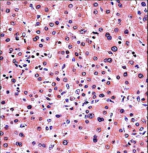 PLAP / Alkaline Phosphatase Antibody - ALPP Antibody immunohistochemistry of formalin-fixed and paraffin-embedded human liver tissue followed by peroxidase-conjugated secondary antibody and DAB staining.