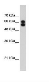 PLAP / Alkaline Phosphatase Antibody - HepG2 Cell Lysate.  This image was taken for the unconjugated form of this product. Other forms have not been tested.