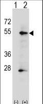 PLAP / Alkaline Phosphatase Antibody - Western blot of ALPP (arrow) using rabbit polyclonal ALPP Antibody. 293 cell lysates (2 ug/lane) either nontransfected (Lane 1) or transiently transfected (Lane 2) with the ALPP gene.
