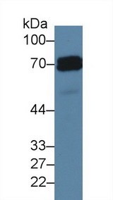 PLAP / Alkaline Phosphatase Antibody - Western Blot; Sample: Human Hela cell lysate; Primary Ab: 5µg/ml Rabbit Anti-Rat ALPP Antibody Second Ab: 0.2µg/mL HRP-Linked Caprine Anti-Rabbit IgG Polyclonal Antibody