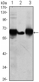 PLAP / Alkaline Phosphatase Antibody - Western blot using ALPP mouse monoclonal antibody against HepG2 (1), A431 (2) and MCF-7 (3) cell lysate.