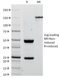 PLAP / Alkaline Phosphatase Antibody - SDS-PAGE Analysis of Purified, BSA-Free Placental Alkaline Phosphatase Antibody (clone ALPP/238). Confirmation of Integrity and Purity of the Antibody.