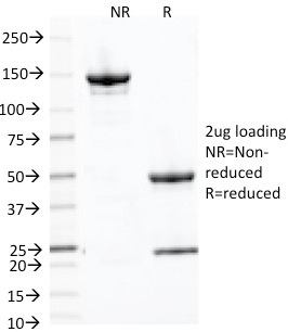 PLAP / Alkaline Phosphatase Antibody - SDS-PAGE Analysis Purified PLAP Mouse Monoclonal Antibody (ALPP/2889R). Confirmation of Purity and Integrity of Antibody.