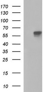 PLAP / Alkaline Phosphatase Antibody - HEK293T cells were transfected with the pCMV6-ENTRY control (Left lane) or pCMV6-ENTRY ALPP (Right lane) cDNA for 48 hrs and lysed. Equivalent amounts of cell lysates (5 ug per lane) were separated by SDS-PAGE and immunoblotted with anti-ALPP.