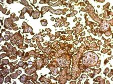 PLAP / Alkaline Phosphatase Antibody - Formalin-fixed, paraffin-embedded human placenta stained with PLAP antibody (SPM593).  This image was taken for the unmodified form of this product. Other forms have not been tested.