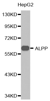 PLAP / Alkaline Phosphatase Antibody - Western blot analysis of extracts of HepG2 cells, using ALPP antibody. The secondary antibody used was an HRP Goat Anti-Rabbit IgG (H+L) at 1:10000 dilution. Lysates were loaded 25ug per lane and 3% nonfat dry milk in TBST was used for blocking.
