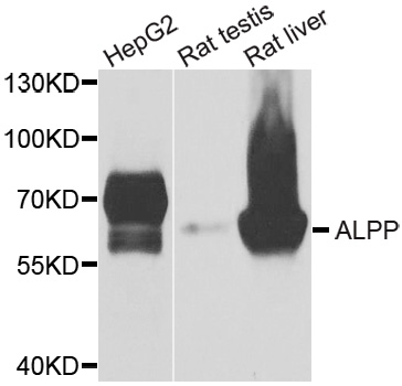 PLAP / Alkaline Phosphatase Antibody - Western blot of extracts of various cell lines, using ALPP antibody.