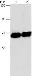 PLAP / Alkaline Phosphatase Antibody - Western blot analysis of HepG2 cell and human placenta tissue, using ALPP Polyclonal Antibody at dilution of 1:1550.