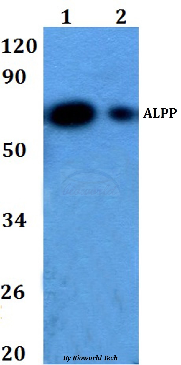 PLAP / Alkaline Phosphatase Antibody - Western blot of ALPP antibody at 1:500 dilution. Lane 1: HEK293T whole cell lysate. Lane 2: Raw264.7 whole cell lysate.