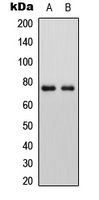 PLAP / Alkaline Phosphatase Antibody - Western blot analysis of ALP expression in HEK293T (A); Raw264.7 (B) whole cell lysates.