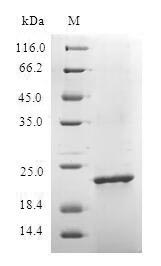 Plasmodium falciparum Protein - (Tris-Glycine gel) Discontinuous SDS-PAGE (reduced) with 5% enrichment gel and 15% separation gel.