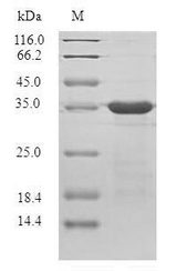 Plasmodium falciparum Protein - (Tris-Glycine gel) Discontinuous SDS-PAGE (reduced) with 5% enrichment gel and 15% separation gel.