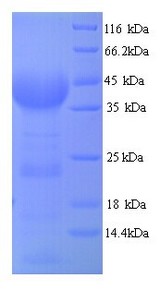 ABCB1 / MDR1 / P Glycoprotein Protein