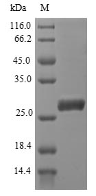 Plasmodium falciparum AMA-1 Protein - (Tris-Glycine gel) Discontinuous SDS-PAGE (reduced) with 5% enrichment gel and 15% separation gel.