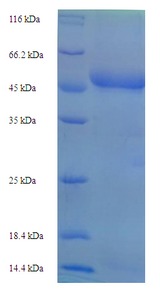 Plasmepsin-1 Protein
